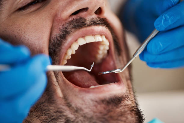 Fast & Reliable Emergency Dental Services in NV
